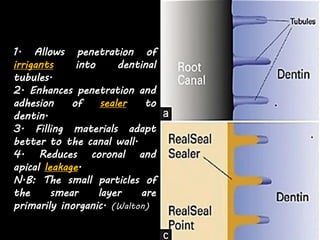 21
1. Allows penetration of
irrigants into dentinal
tubules.
2. Enhances penetration and
adhesion of sealer to
dentin.
3. Filling materials adapt
better to the canal wall.
4. Reduces coronal and
apical leakage.
N.B: The small particles of
the smear layer are
primarily inorganic. (Walton)
 