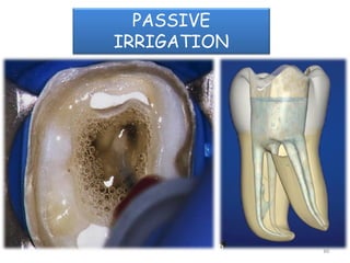 60
PASSIVE
IRRIGATION
 
