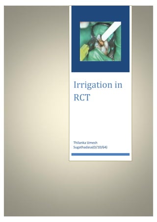 Irrigation in
RCT
Thilanka Umesh
Sugathadasa(D/10/64)
 