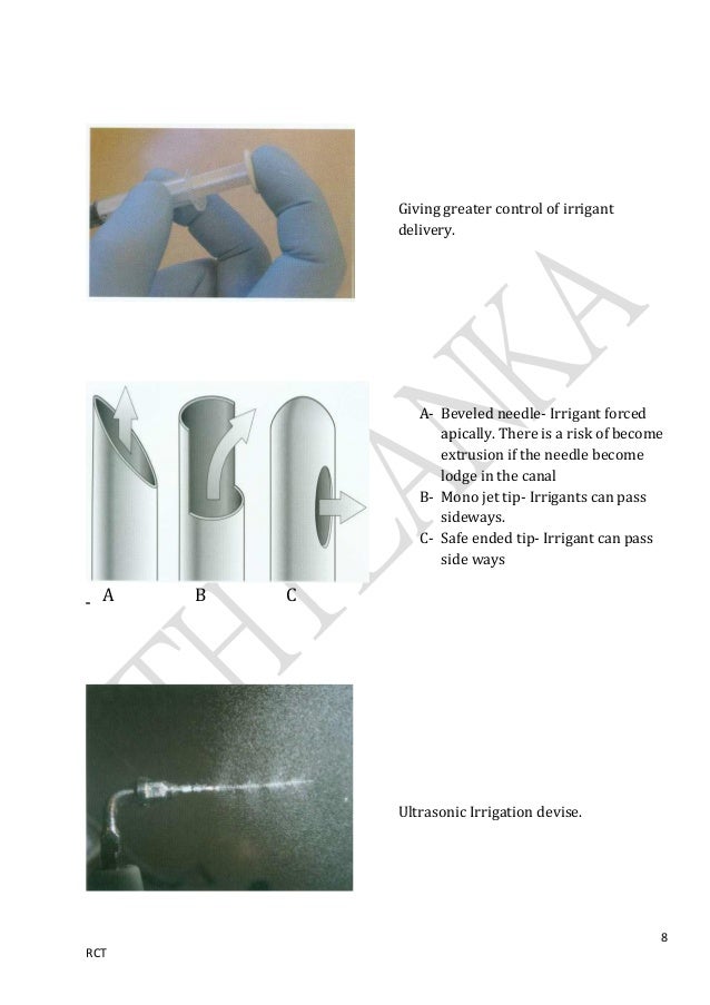 Irrigation in endodontics