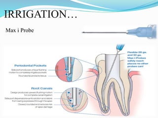IRRIGATION…
Max i Probe
 