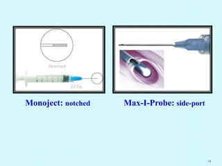 14
Monoject: notched Max-I-Probe: side-port
 