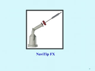 17
NaviTip FX
 