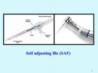 52
Self adjusting file (SAF)
 
