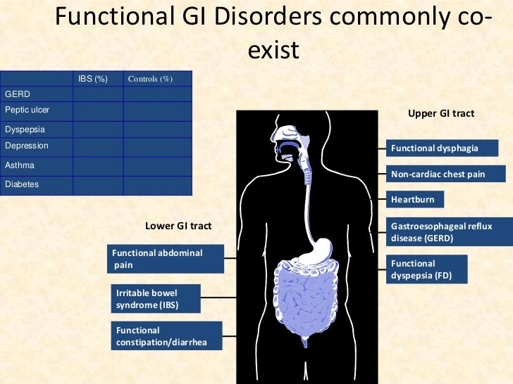 Irritable bowel syndrome