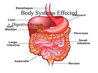Body Systems Effected
• Digestive System
 
