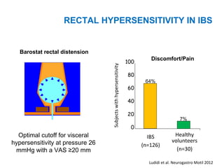 0
20
40
60
80
100
IBS
(n=126)
Healthy
volunteers
(n=30)
Subjectswithhypersensitivity
Barostat rectal distension
Discomfort/Pain
Ludidi et al. Neurogastro Motil 2012
Optimal cutoff for visceral
hypersensitivity at pressure 26
mmHg with a VAS ≥20 mm
RECTAL HYPERSENSITIVITY IN IBS
64%
7%
 