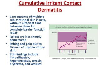 Cumulative Irritant Contact
Dermatitis
• Consequence of multiple
sub-threshold skin insults,
without sufficient time
between them for
complete barrier function
repair
• lesions are less sharply
demarcated
• Itching and pain due to
fissures of hyperkeratotic
skin.
• Skin findings include
lichenification,
hyperkeratosis, xerosis,
erythema, and vesicles
 