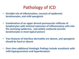 Pathology of ICD
• Variable mix of inflammation, necrosis of epidermal
keratinocytes, and mild spongiosis
• Combination of an upper dermal perivascular infiltrate of
lymphocytes with minimal extension of inflammatory cells into
the overlying epidermis, and widely scattered necrotic
keratinocytes is most typical picture
• True features of interface dermatitis are absent, and spongiosis
should be focal or absent
• Over time additional histologic findings include acanthosis with
mild hypergranulosis and hyperkeratosis
 