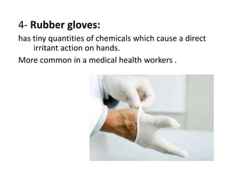 4- Rubber gloves:
has tiny quantities of chemicals which cause a direct
irritant action on hands.
More common in a medical health workers .
 