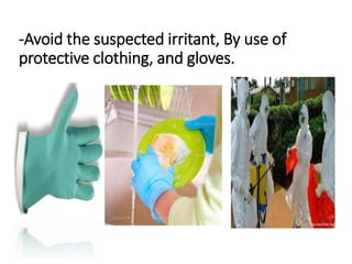 -Avoid the suspected irritant, By use of
protective clothing, and gloves.
 
