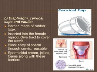 Reproductive health- class 12 cbse | PPTX