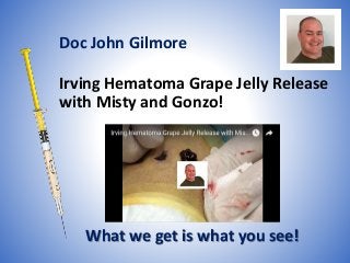Irving Hematoma Grape Jelly Release
with Misty and Gonzo!
What we get is what you see!
Doc John Gilmore
 