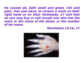 He causes all, both small and great, rich and poor, free and slave, to receive a mark on their right hand or on their foreheads, 17 and that no one may buy or sell except one who has the mark or the name of the beast, or the number of his name. Revelation 13:16, 17 