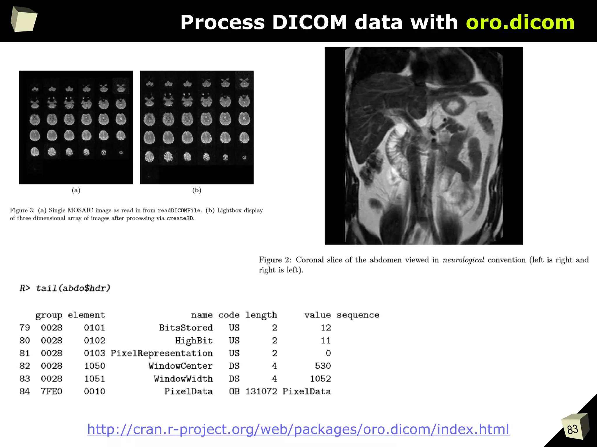 83
Process DICOM data with oro.dicom
http://cran.r-project.org/web/packages/oro.dicom/index.html
 