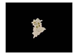 Is scrum incompatible with your brain