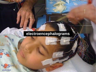 electroencephalograms




photo credit
 