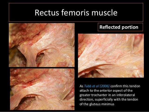 isabel miguel quadriceps muscle anatomy cadaver study prp
