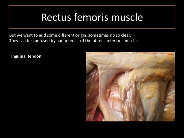 isabel miguel quadriceps muscle anatomy cadaver study prp