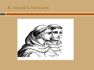 A monk’s tonsure
 