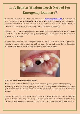 Is A Broken Wisdom Tooth Needed For
Emergency Dentistry?
A broken tooth is all-natural. But if you experience a broken wisdom tooth, then this should
be a consideration for an Emergency Dentistry Near Me. your dentist is very likely to
recommend wisdom tooth removal. While it is possible to maintain the broken tooth, to
avoid further complications, it is best to get the tooth removed completely.
Wisdom teeth are known as third molars and usually happen in a person between the ages of
17 and 26. They do not always develop through the gums at all, and if they do, sometimes
they may not be straight.
In these cases, there may be an improved risk of disease. Gaps allow trash to gather and
bacteria to grow, which raises the risk of gum disease and tooth decay. Specialists
recommend the early removal of wisdom teeth to avoid such incidents.
What can cause a broken wisdom tooth?
Wisdom teeth are the last to develop, there may be less space in your mouth for growing.
As they try to explode through your gum, another tooth may already be obtaining the same
spot. Your wisdom tooth may develop at an abnormal angle, or even crack as it makes its
way out.
Wisdom teeth may be more liable to break than your other teeth if they have not enough
space to develop. You may have many challenging difficulties to use those teeth to chew,
and there is a higher chance of gum decay if it is harder to clean completely around that area.
 