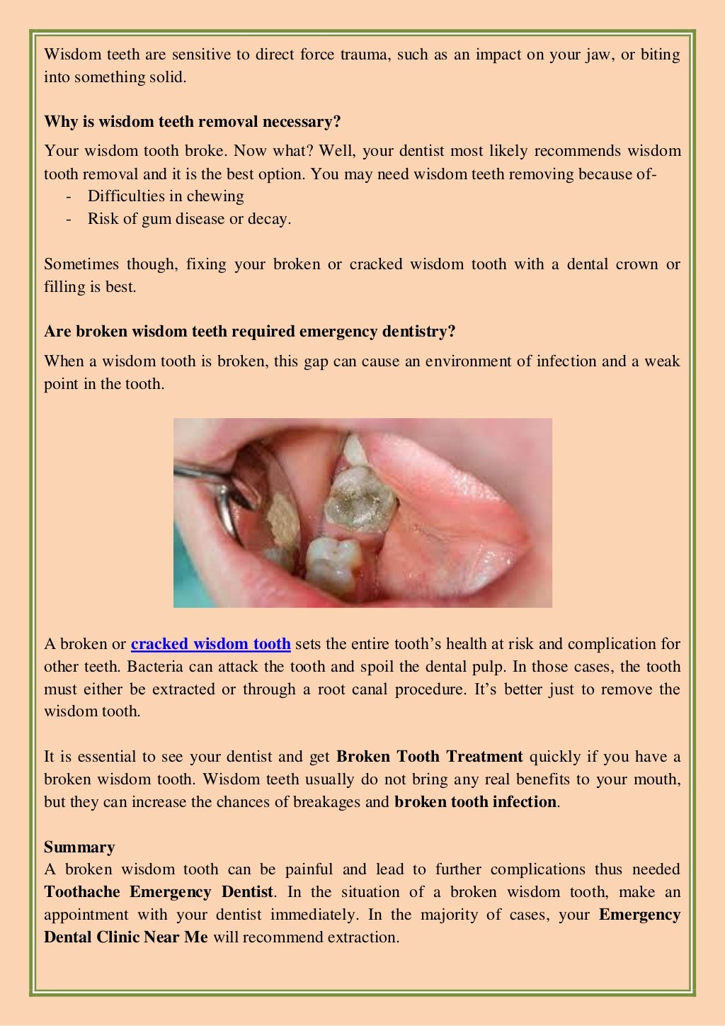Is A Broken Wisdom Tooth Needed For Emergency Dentistry