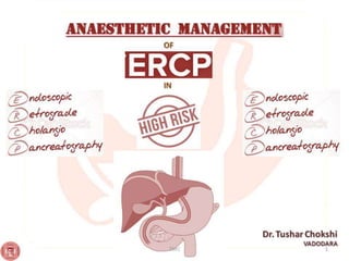 Anesthetic management of ERCP patient tushar chokshi