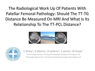 The Radiological Work Up Of Patients With
Patellar Femoral Pathology: Should The TT-TG
Distance Be Measured On MRI And What Is Its
Relationship To The TT-PCL Distance?
C Anley1, G Morris1, A Saithna1, S James2, M Snow1
1 Arthroscopy Division, The Royal Orthopaedic Hospital, Birmingham, UK
2 Radiology Department, The Royal Orthopaedic Hospital, Birmingham, UK
 