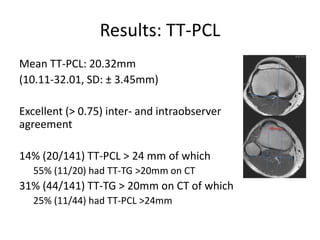 Results: TT-PCL
Mean TT-PCL: 20.32mm
(10.11-32.01, SD: ± 3.45mm)
Excellent (> 0.75) inter- and intraobserver
agreement
14% (20/141) TT-PCL > 24 mm of which
55% (11/20) had TT-TG >20mm on CT
31% (44/141) TT-TG > 20mm on CT of which
25% (11/44) had TT-PCL >24mm
 