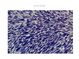 Siilin piikit 