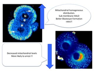 Mitochondrial homogeneous
distribution.
Sub membrane HALO
Better Blastocyst Formation
rates!!
Decreased mitochondrial levels
More likely to arrest !!
 