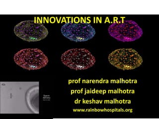 INNOVATIONS IN A.R.T
prof narendra malhotra
prof jaideep malhotra
dr keshav malhotra
www.rainbowhospitals.org
 