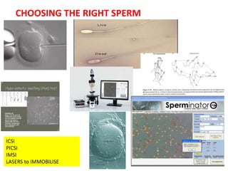 V I T A L I T Y
CHOOSING THE RIGHT SPERM
ICSI
PICSI
IMSI
LASERS to IMMOBILISE
 