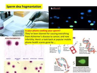 Sperm dna fragmantation
Is your phone cooking your sperm?
They’ve been blamed for causing everything
from Alzheimer’s disease to cancer, and now
infertility. Here’s a look back at popular mobile
phone health scares gone by …
 