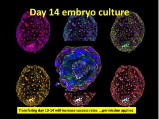Day 14 embryo culture
Transfering day 13-14 will increase success rates …permission applied
 