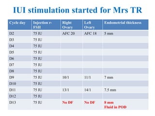 Cycle day Injection r-
FSH
Right
Ovary
Left
Ovary
Endometrial thickness
D2 75 IU AFC 20 AFC 18 5 mm
D3 75 IU
D4 75 IU
D5 75 IU
D6 75 IU
D7 75 IU
D8 75 IU
D9 75 IU 10/1 11/1 7 mm
D10 75 IU
D11 75 IU 13/1 14/1 7.5 mm
D12 75 IU
D13 75 IU No DF No DF 8 mm
Fluid in POD
IUI stimulation started for Mrs TR
 