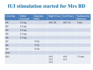 Cycle day Tablet
Letrozole
Injection
hMG
Right Ovary Left Ovary Endometrial
thickness
D2 2.5 mg AFC 20 AFC 18 5 mm
D3 2.5 mg
D4 2.5 mg
D5 2.5 mg
D6 2.5 mg
D7 75 IU
D8 75 IU
D9 75 IU
D10
D11 14/2
13/2
12/5
14/3
11/2
7.5 mm
IUI stimulation started for Mrs BD
 