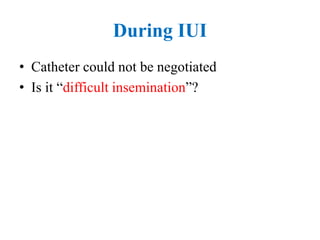 During IUI
• Catheter could not be negotiated
• Is it “difficult insemination”?
 
