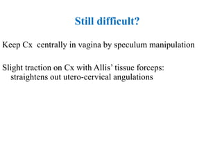 Still difficult?
Keep Cx centrally in vagina by speculum manipulation
Slight traction on Cx with Allis’ tissue forceps:
straightens out utero-cervical angulations
 