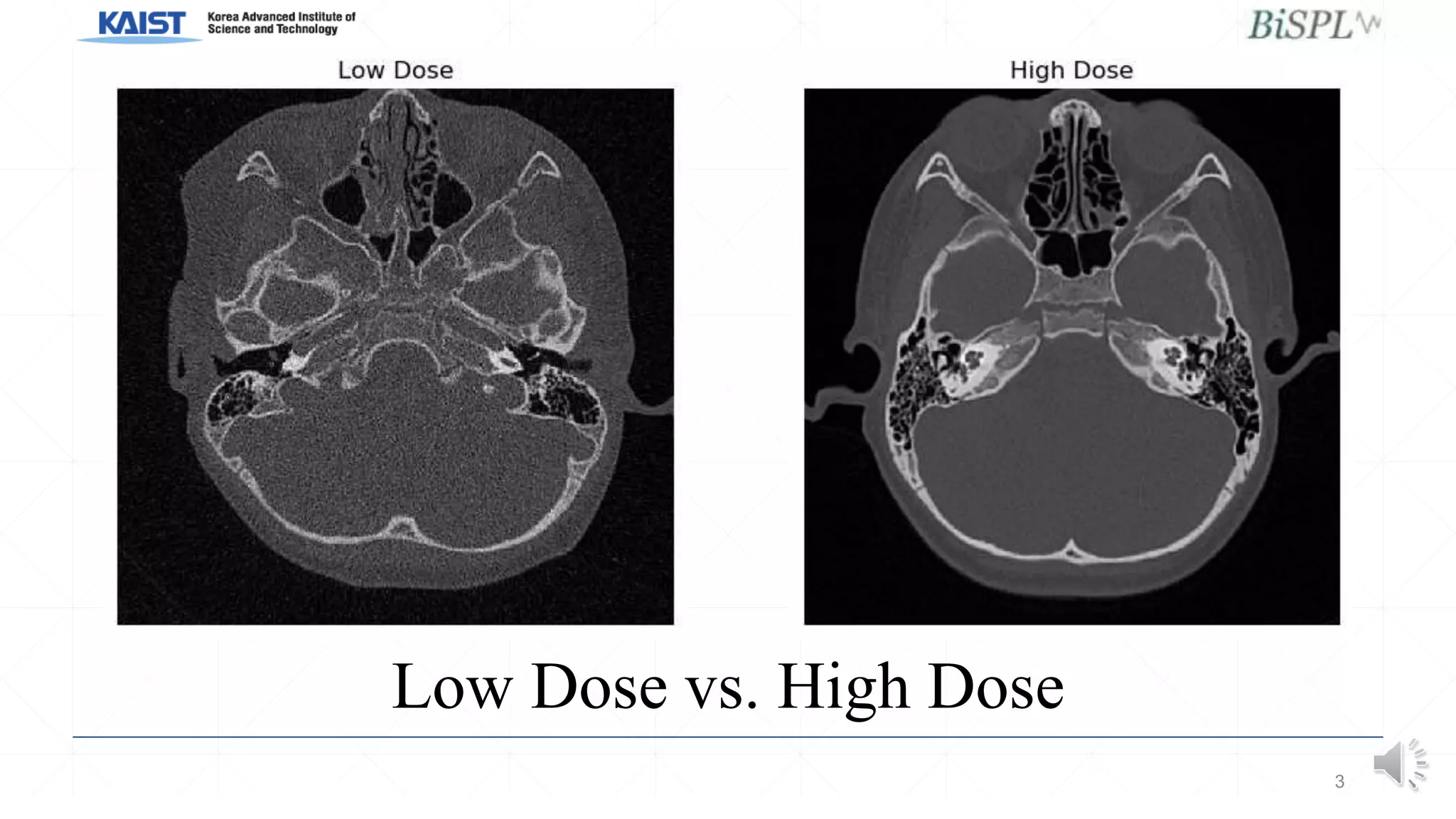 Low Dose vs. High Dose
3
 