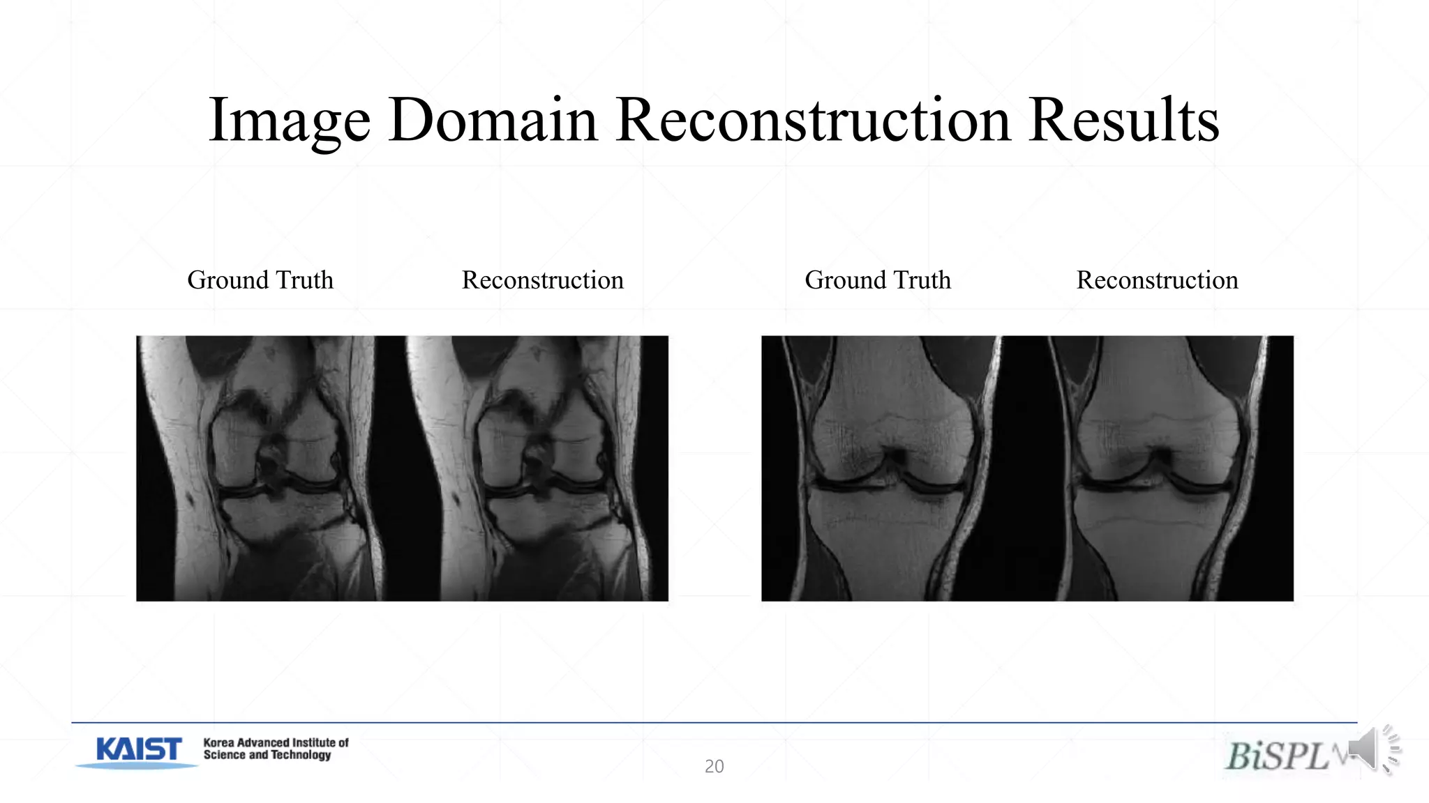 Image Domain Reconstruction Results
20
Ground Truth Reconstruction Ground Truth Reconstruction
 