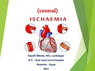 (central) 
I S C H A E M I A 
Sayed Sileem, MSc. cardiologist 
ICU – Kafr Saad central hospital 
Damietta – Egypt 
2014 
 