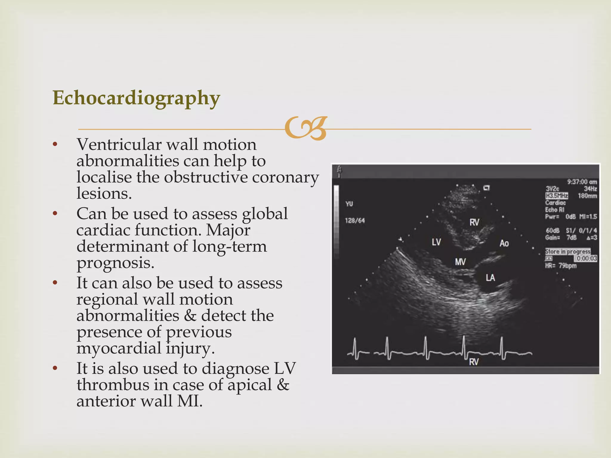 Anaesthetic Management of a Patient with Ischaemic Heart Disease | PPTX