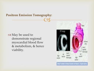 
Positron Emission Tomography:
 May be used to
demonstrate regional
myocardial blood flow
& metabolism, & hence
viabilit...