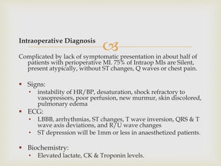 Intraoperative Diagnosis
Complicated by lack of symptomatic presentation in about half of
patients with perioperative MI....