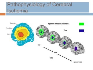 Pathophysiology of Cerebral
Ischemia
 