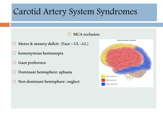  MCAocclusion
 Motor&sensorydeficit (Face>UL>LL)
 homonymoushemianopia
 Gazepreference
 Dominanthemisphere:aphasia
 Nondominanthemisphere:neglect
Carotid Artery System Syndromes
 