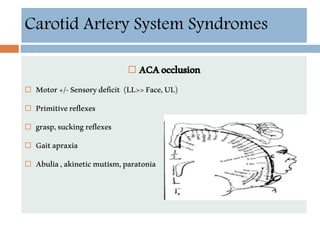  ACAocclusion
 Motor+/-Sensorydeficit (LL>>Face,UL)
 Primitivereflexes
 grasp,suckingreflexes
 Gaitapraxia
 Abulia,akineticmutism,paratonia
Carotid Artery System Syndromes
 