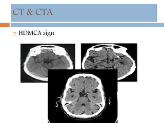CT & CTA
 HDMCA sign
 