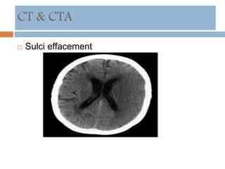  Sulci effacement
CT & CTA
 